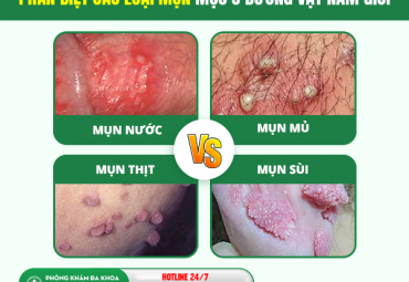 duong-vat-noi-mun-la-chuoi-hat-ngoc-hay-sui-mao-ga-cach-nhan-biet