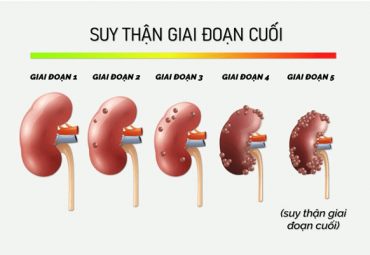 tieu-ca-chuc-lan-moi-ngay-coi-chung-benh-than-tieu-duong-dang-am-tham-tien-trien